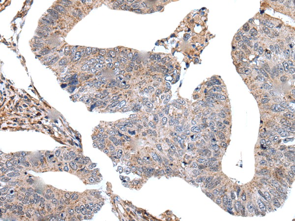 USP37 Polyclonal Antibody (E-AB-19606)