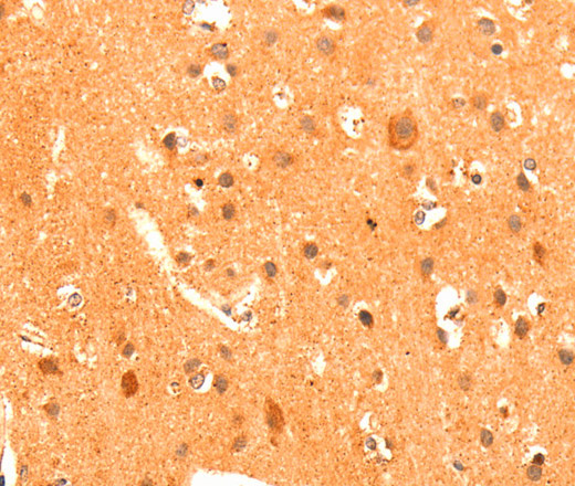GRM3 Polyclonal Antibody (E-AB-14110)