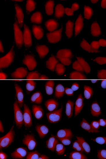 TAP2 Polyclonal Antibody (E-AB-60369)