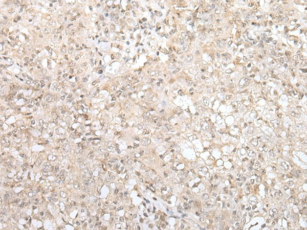 ZNF263 Polyclonal Antibody (E-AB-52379)