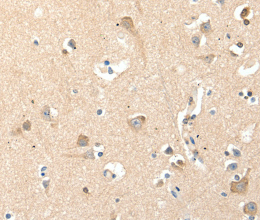 RRAD Polyclonal Antibody (E-AB-16047)