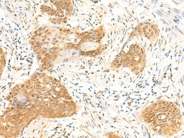 TBPL1 Polyclonal Antibody (E-AB-18925)