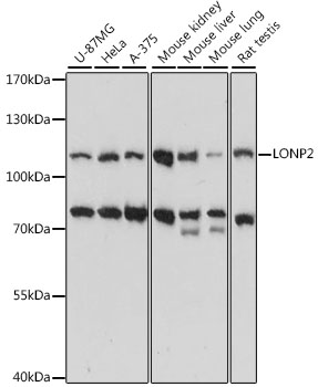 LONP2 Polyclonal Antibody (E-AB-91344)