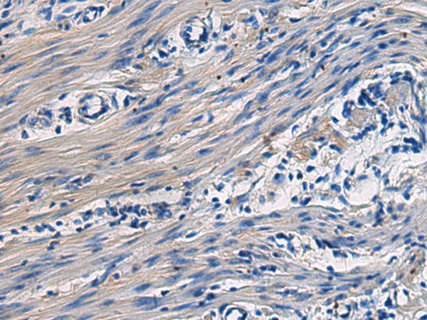 COL17A1 Polyclonal Antibody (E-AB-19718)