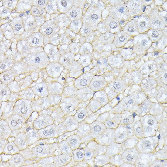 SPTAN1 Polyclonal Antibody (E-AB-63995)