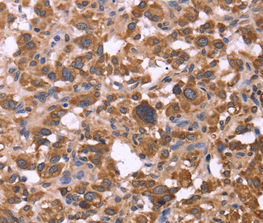 FBXW7 Polyclonal Antibody (E-AB-14856)