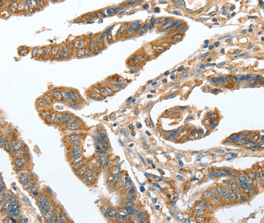 CKAP2 Polyclonal Antibody (E-AB-11085)