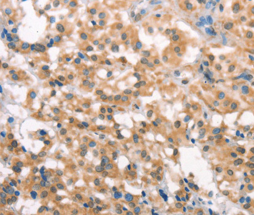 LATS2 Polyclonal Antibody (E-AB-15942)
