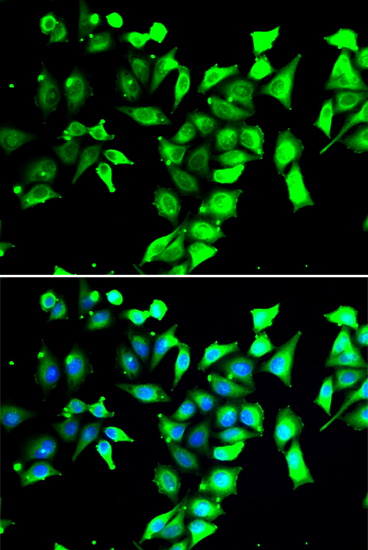FKBP8 Polyclonal Antibody (E-AB-61515)