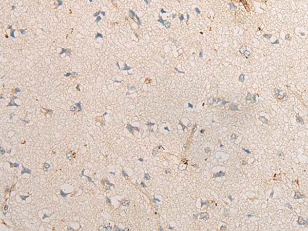PPM1D Polyclonal Antibody (E-AB-52172)
