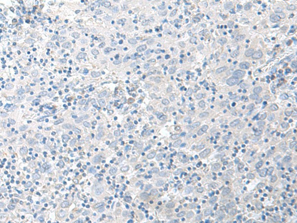 STAU2 Polyclonal Antibody (E-AB-18765)
