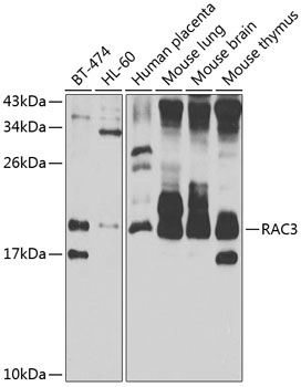 RAC3 Polyclonal Antibody (E-AB-67879)