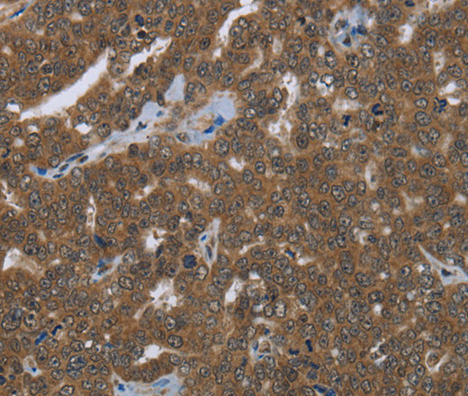 FASTKD1 Polyclonal Antibody (E-AB-15020)