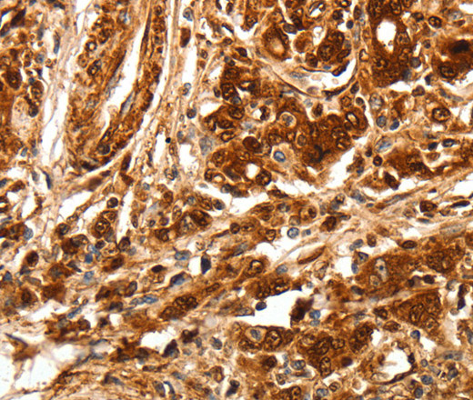 TGF β Receptor I Polyclonal Antibody (E-AB-16094)