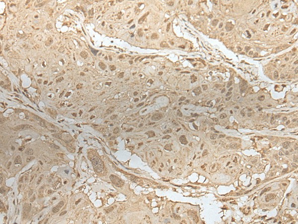 ZBTB18 Polyclonal Antibody (E-AB-18456)