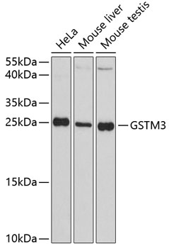 GSTM3 Polyclonal Antibody (E-AB-65457)