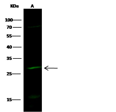 HPGD/15-PGDH Monoclonal Antibody (AN200014P)
