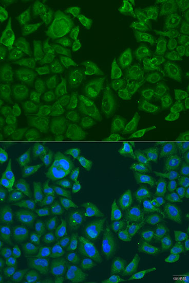 NLRP2 Polyclonal Antibody (E-AB-67966)