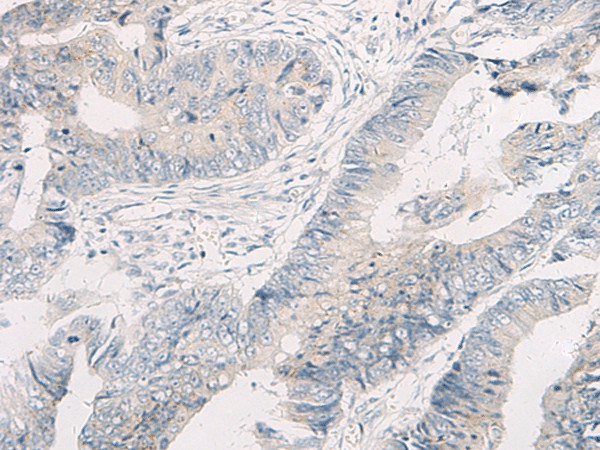 WNK4 Polyclonal Antibody (E-AB-19365)