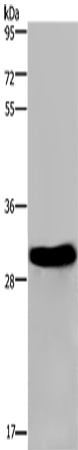 FHL2 Polyclonal Antibody (E-AB-15037)