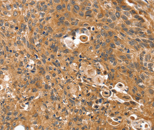 SSX2IP Polyclonal Antibody (E-AB-15414)