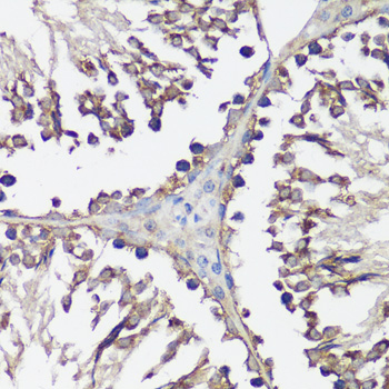 VAMP2 Polyclonal Antibody (E-AB-60284)