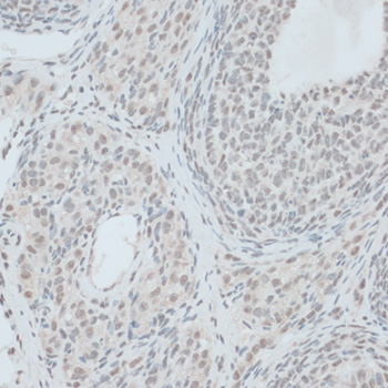ZNF416 Polyclonal Antibody (E-AB-66366)