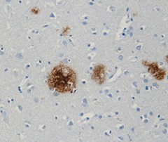 Biotin anti-β-Amyloid, x-42 Antibody (Previously Covance catalog# SIG-39170) (812103)