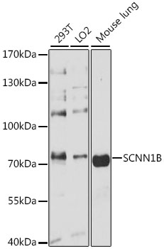 SCNN1B Polyclonal Antibody (E-AB-91852)