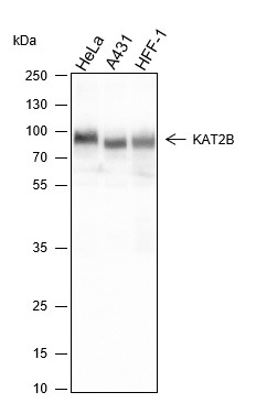 Recombinant PCAF Monoclonal Antibody (AN301572L)
