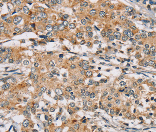 RAB24 Polyclonal Antibody (E-AB-13552)
