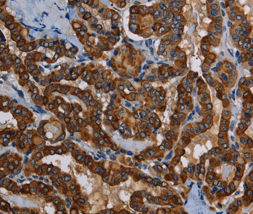 PIDD1 Polyclonal Antibody (E-AB-15177)