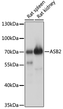 ASB2 Polyclonal Antibody (E-AB-91954)