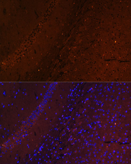 RUSC1 Polyclonal Antibody (E-AB-65309)