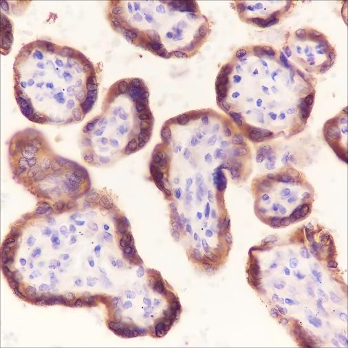 Recombinant Laminin beta 1 Monoclonal Antibody (AN301585L)