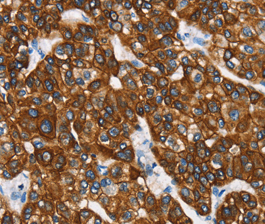 CK-8 Polyclonal Antibody (E-AB-13908)