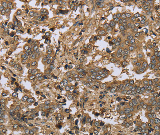 IKBIP Polyclonal Antibody (E-AB-15128)