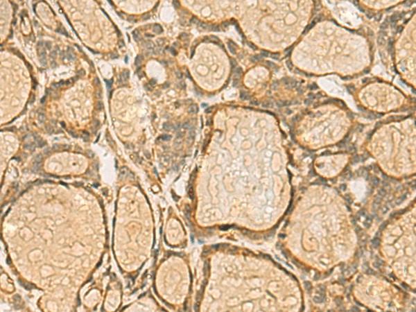 HORMAD2 Polyclonal Antibody (E-AB-19220)