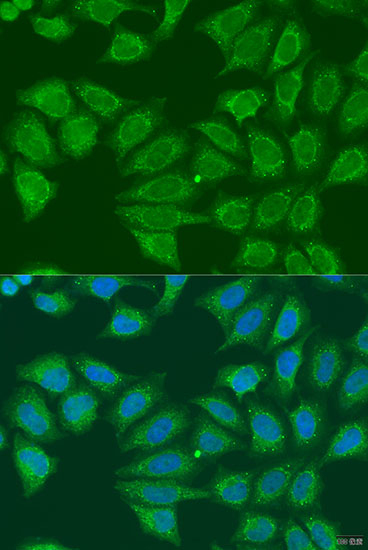 ADH7 Polyclonal Antibody (E-AB-62612)