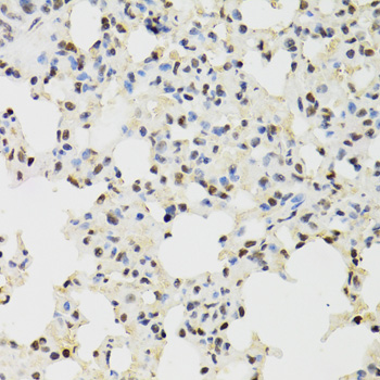 KDM4A Polyclonal Antibody (E-AB-62318)