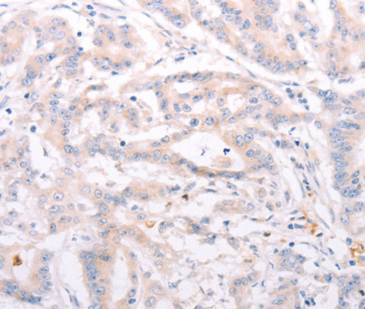 ANKRA2 Polyclonal Antibody (E-AB-12719)