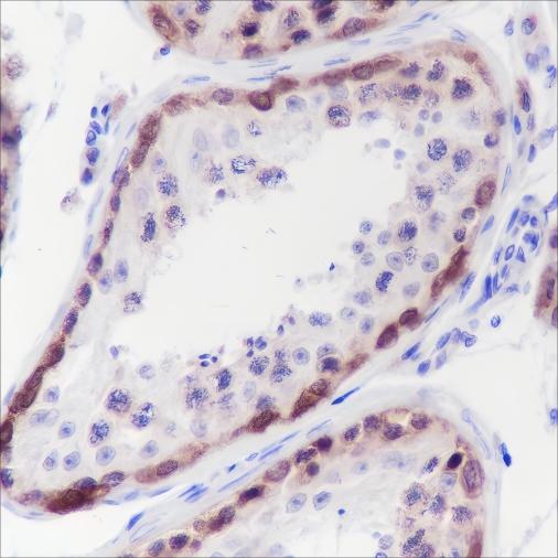 Recombinant CTAG1B Monoclonal Antibody (AN301501L)