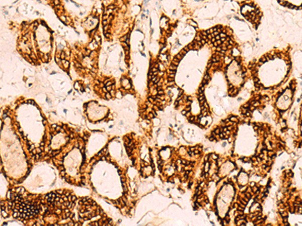 EPCAM Polyclonal Antibody (E-AB-53143)