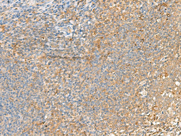 GRIK2 Polyclonal Antibody (E-AB-19966)