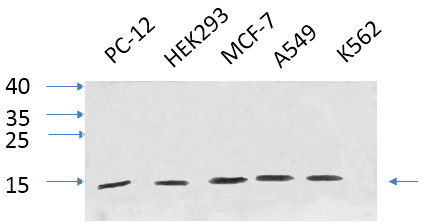 IL8 Polyclonal Antibody (E-AB-33423)