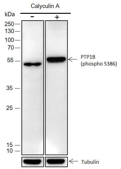 Recombinant Phospho-PTP1B (Ser386) Monoclonal Antibody (AN301643L)
