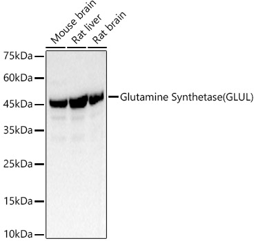 Glutamine Synthetase Polyclonal Antibody (E-AB-93350)