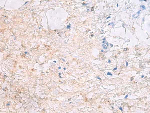 DPCD Polyclonal Antibody (E-AB-19791)
