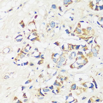 CADPS Polyclonal Antibody (E-AB-67023)