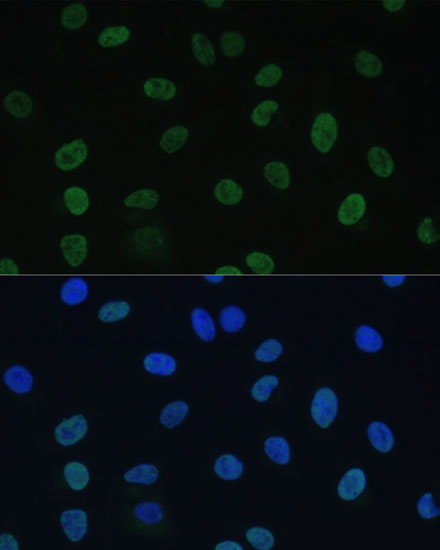 GTF2E1 Polyclonal Antibody (E-AB-65243)
